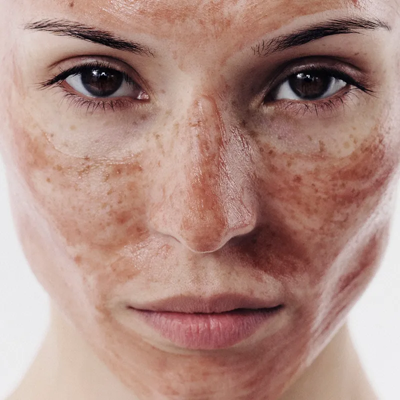 Dr. Emi Arpa Pore Perfection lermaske niacinamid