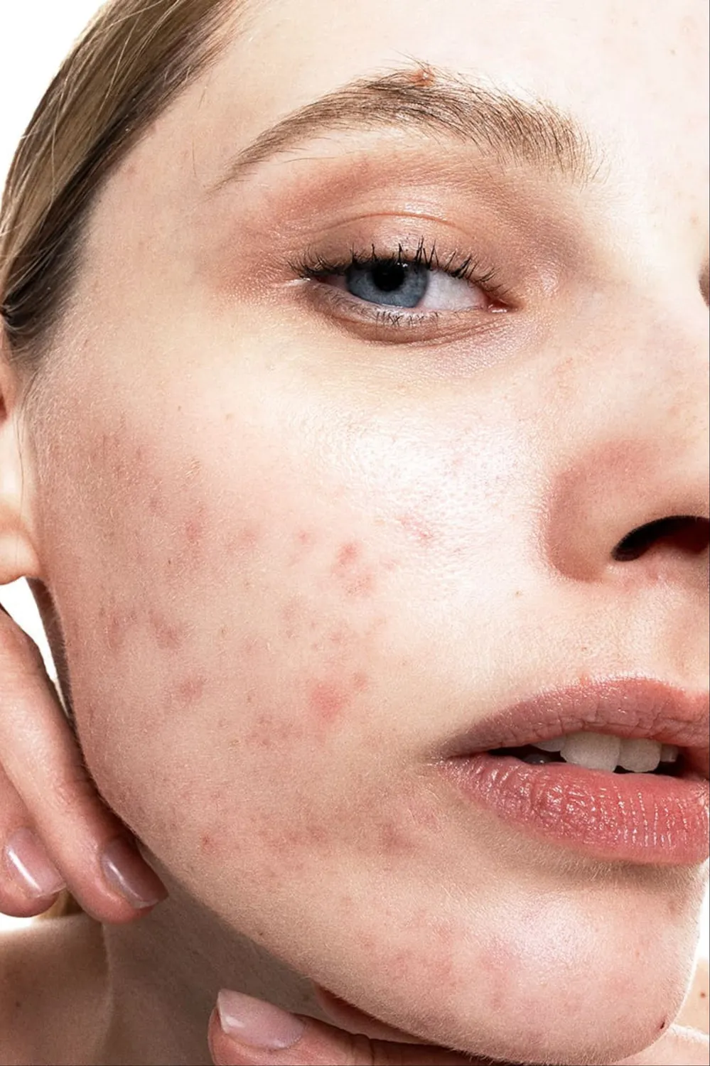 Allies of Skin Clarify and Firm Routine hudplejesæt uren hud