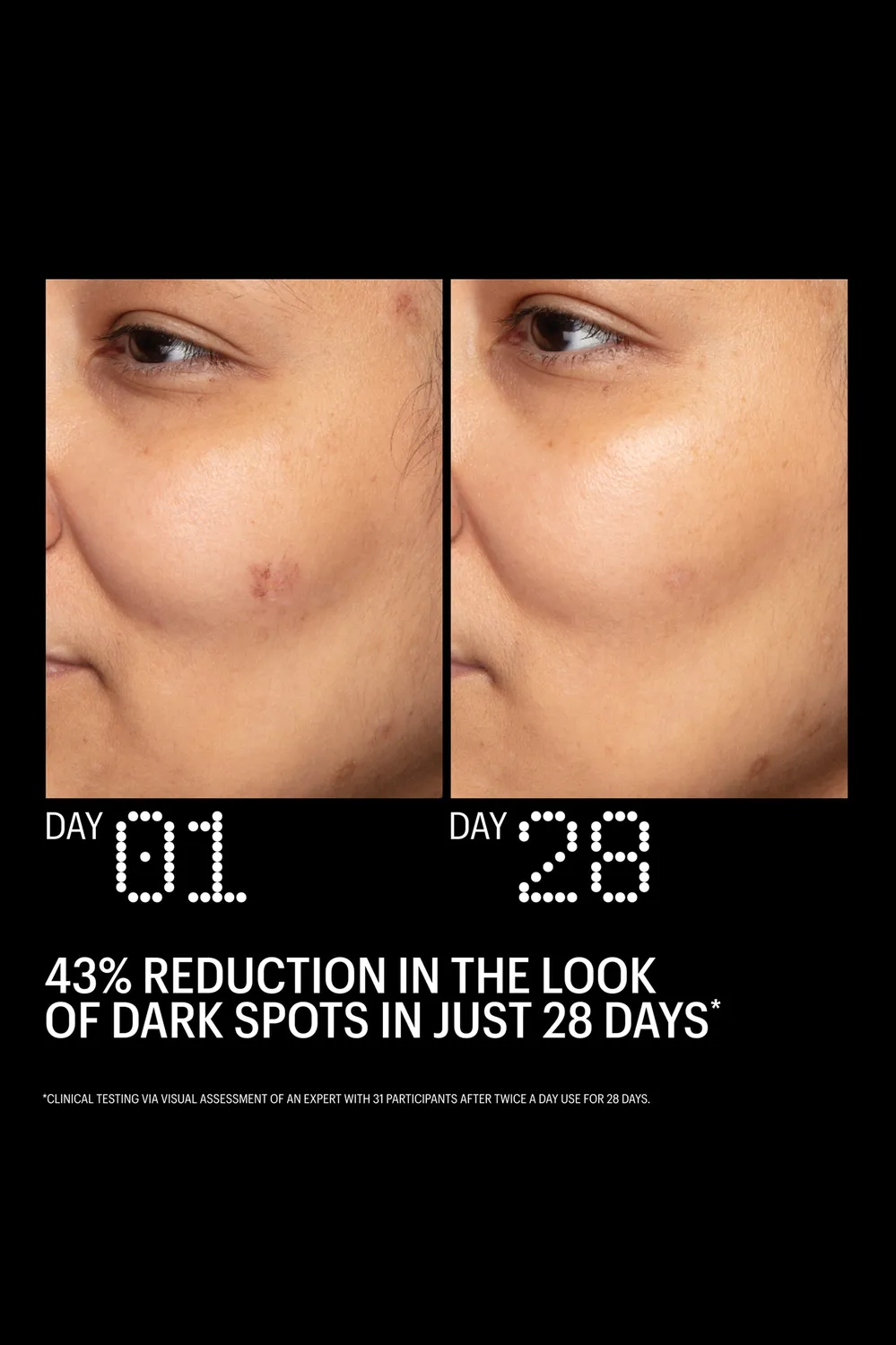 Allies of Skin Azelaic & Kojic Serum Value Size ujævn hud