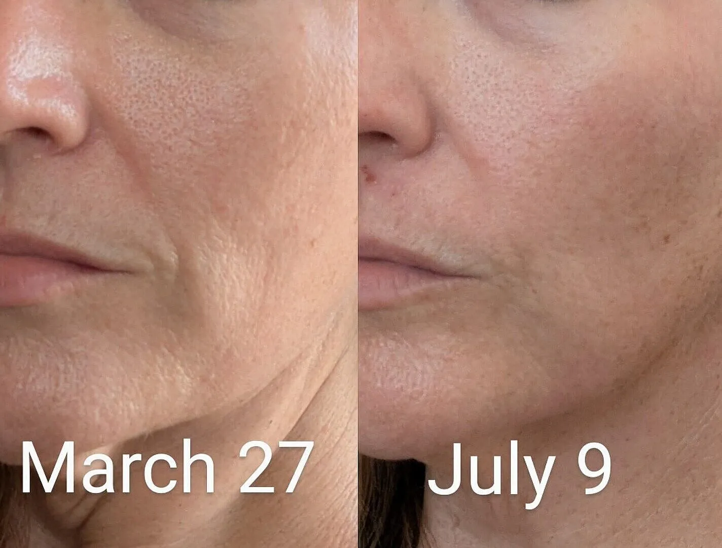 Allies of Skin Multi Peptides & GF Advanced Lifting Serum løftende