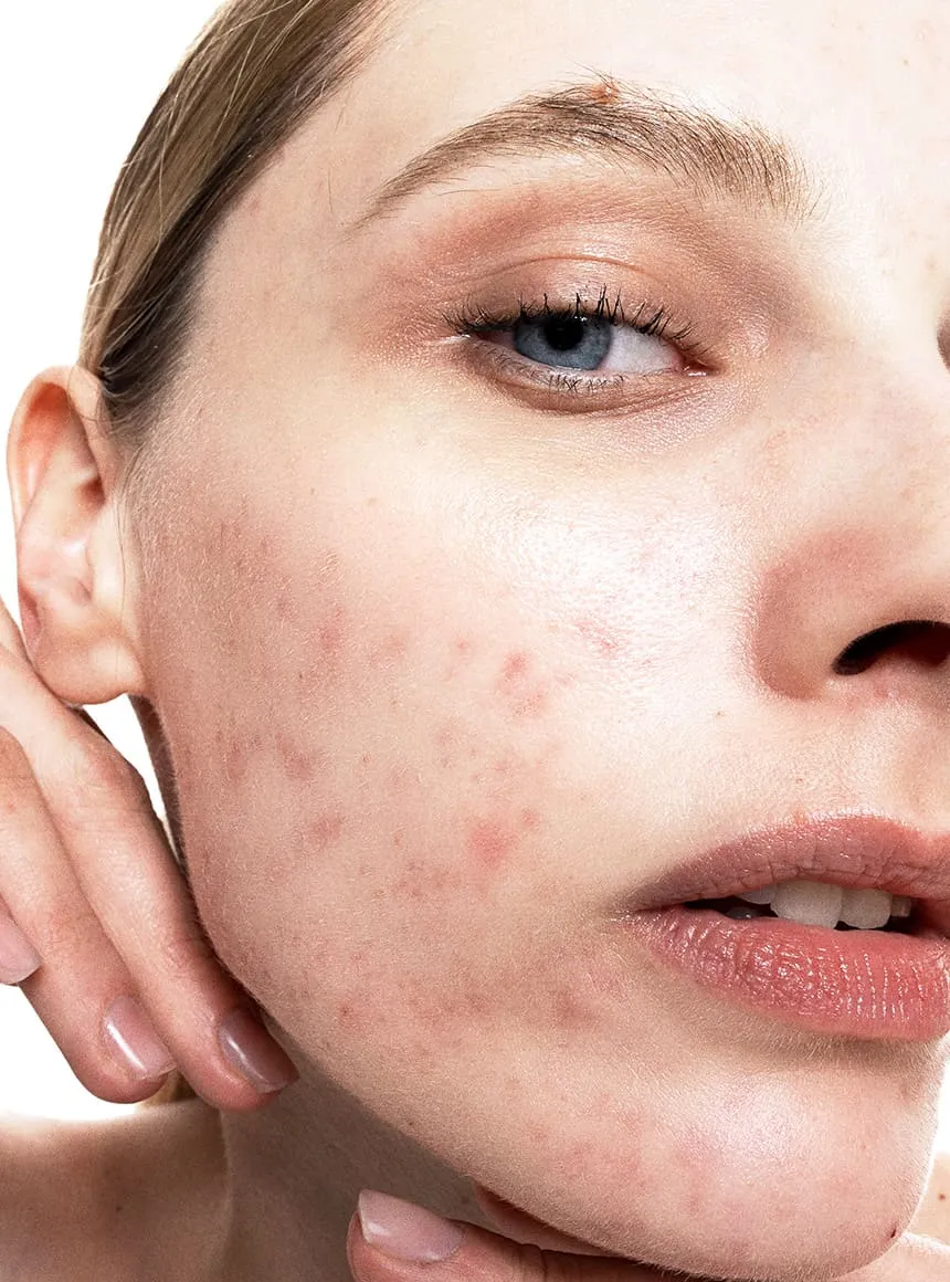 Allies of Skin Cleanse + Clear Duo rensesæt uren hud